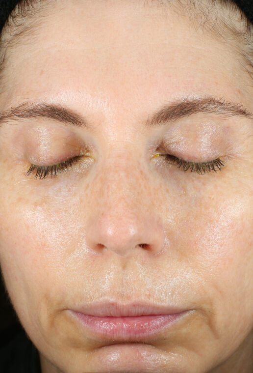 Renewal Crème | Renewal Cream For Dry Skin | ZO Skin Health, Inc.